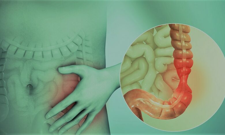  تخلص من ألم القولون العصبي بدون أدوية .. وهذه الأكلات تفاقم المشكلة